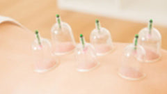 Cupping: To Do or Not to Do?